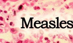 NC Health Officials Urge Caution on Measles measles